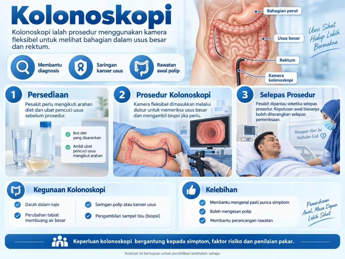 Infografik kolonoskopi.