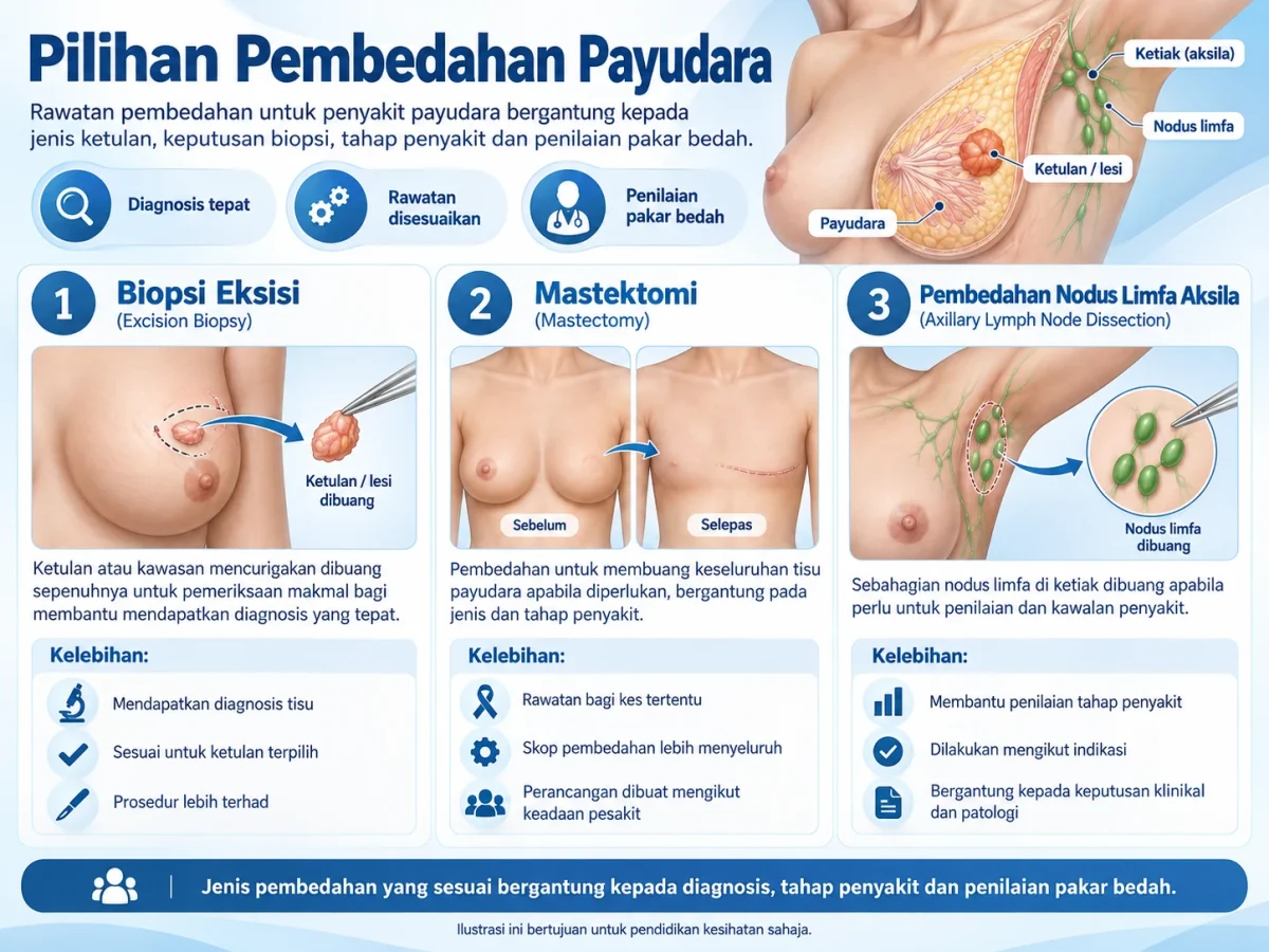 Infografik pilihan pembedahan payudara.