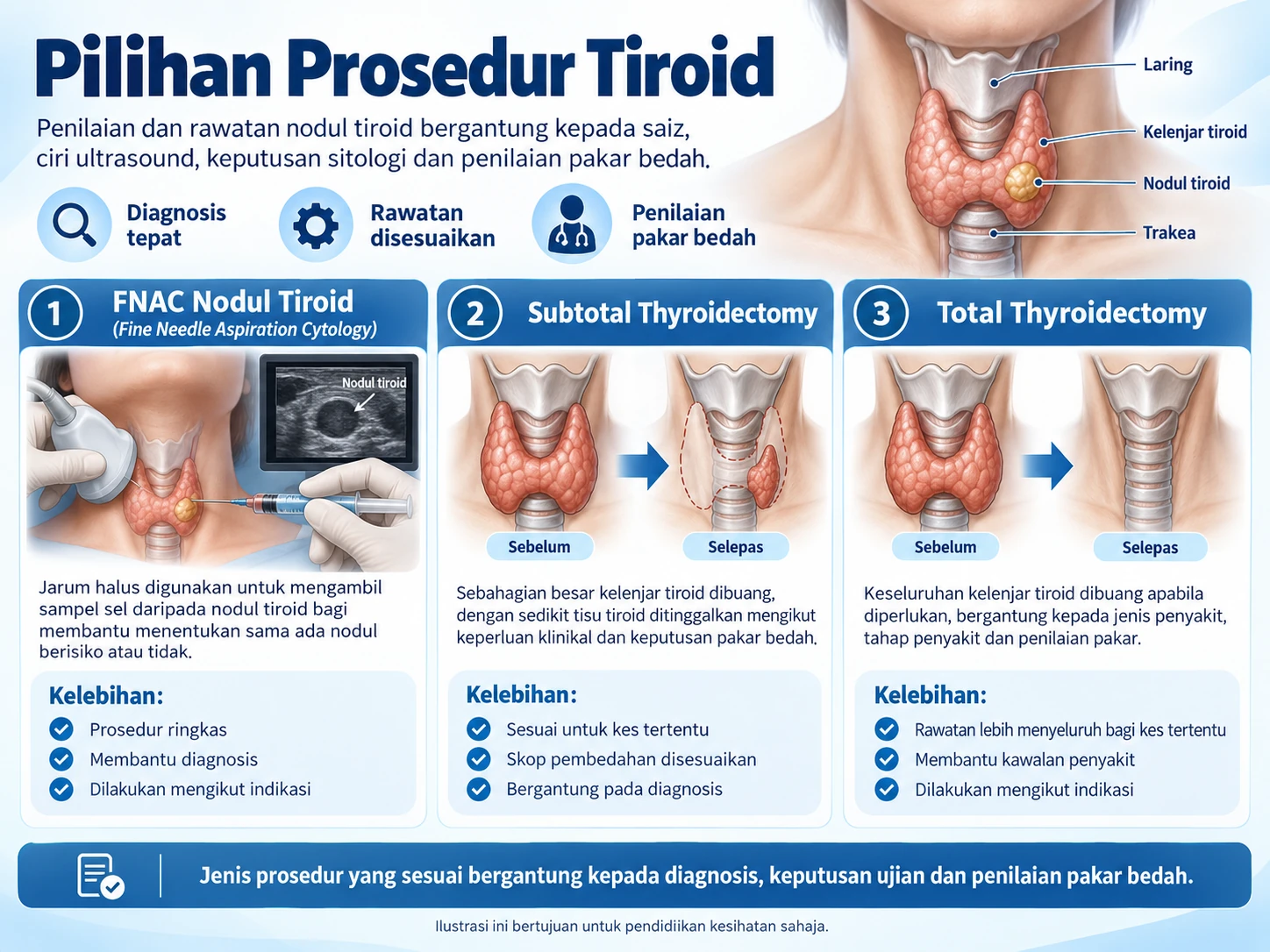 Infografik pilihan prosedur tiroid, menunjukkan FNAC nodul tiroid serta tiroidektomi separa dan penuh.